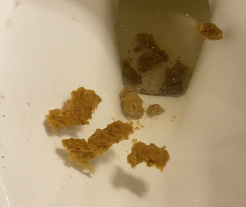 Shit Drips From My Hole with Farts