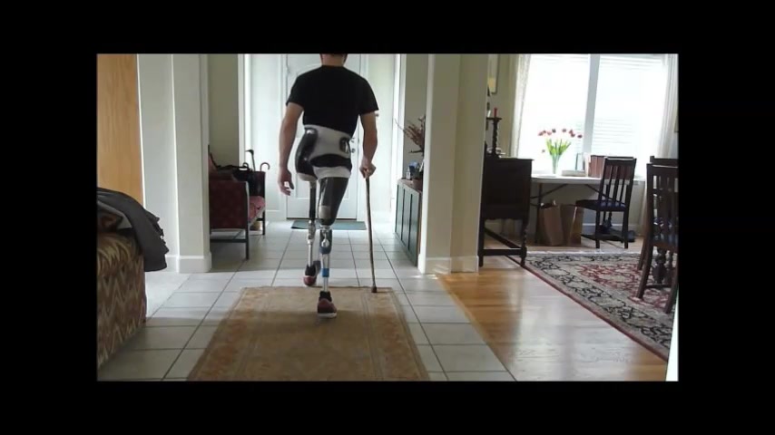 DAK man with prosthesis