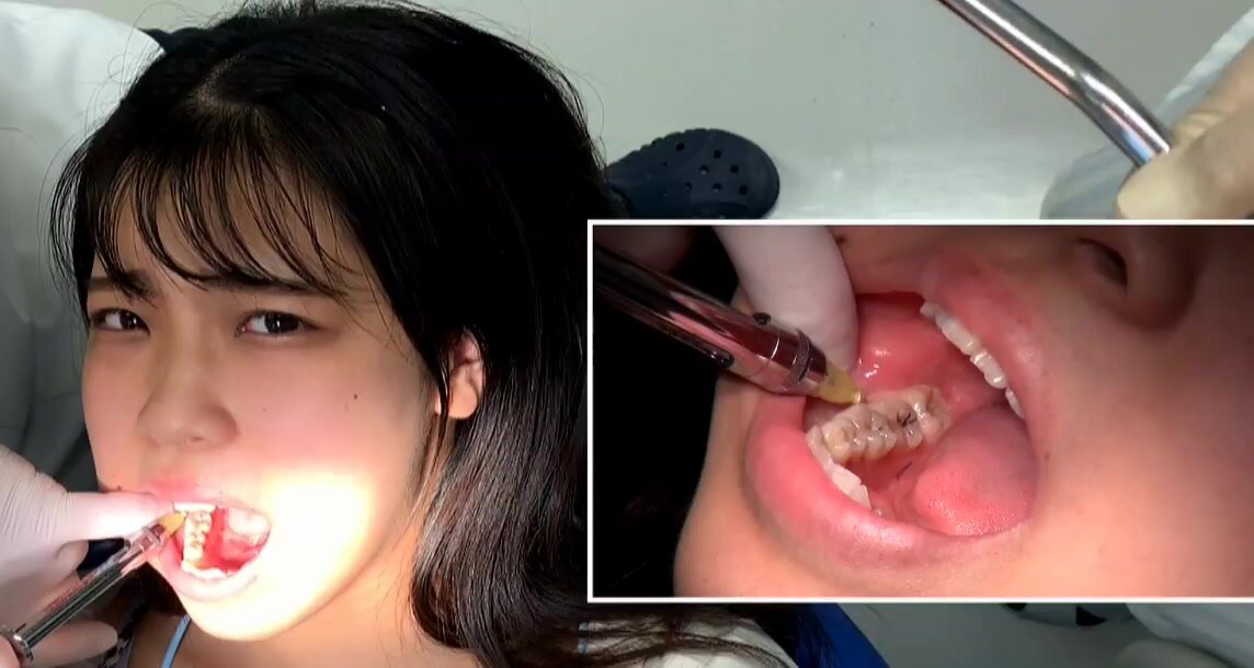 Girl gets injection at dentist more to come