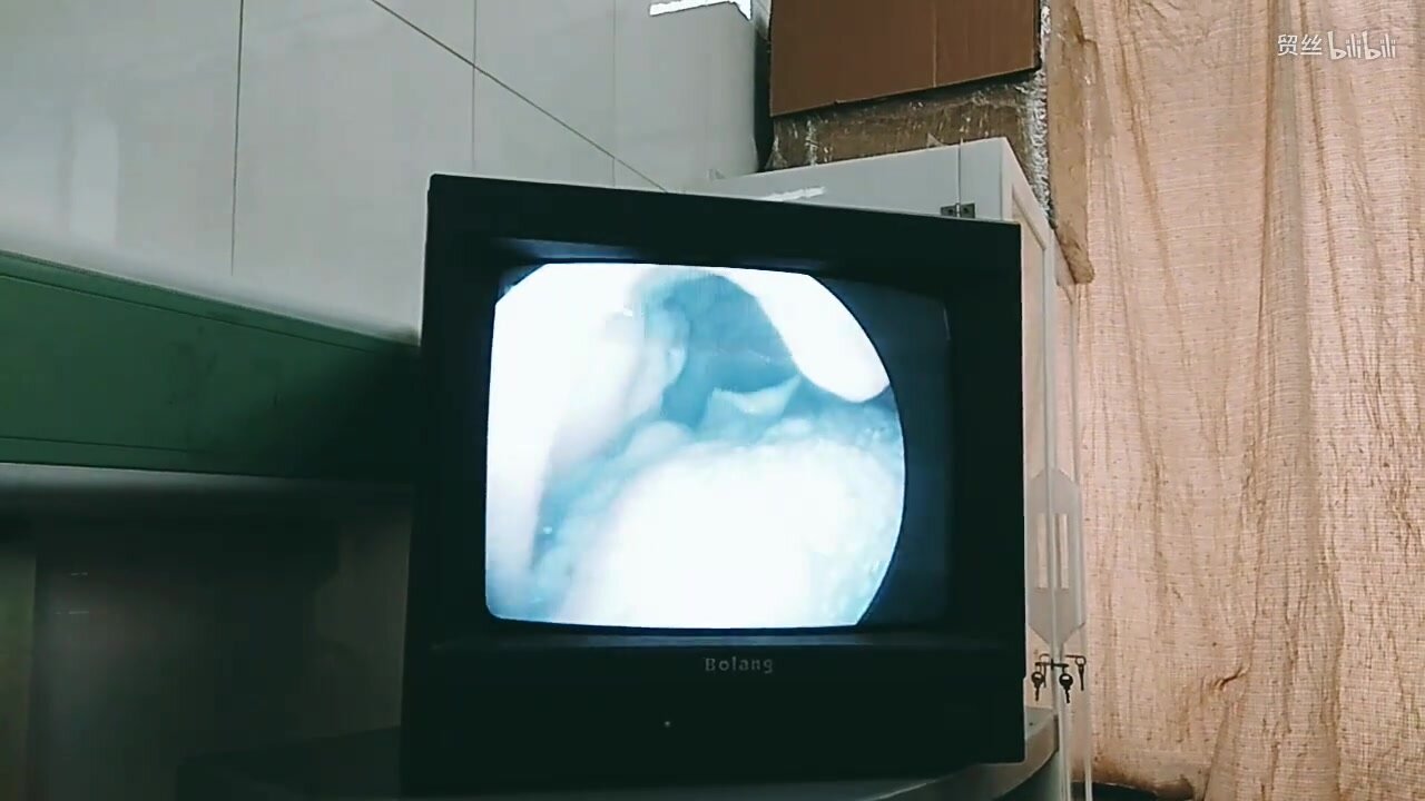 Chinese girl's endoscopy by mouth