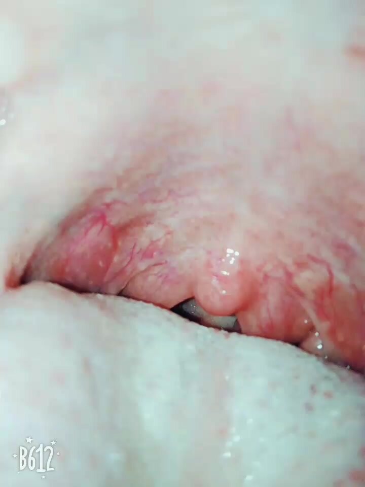 small throat and cute uvula