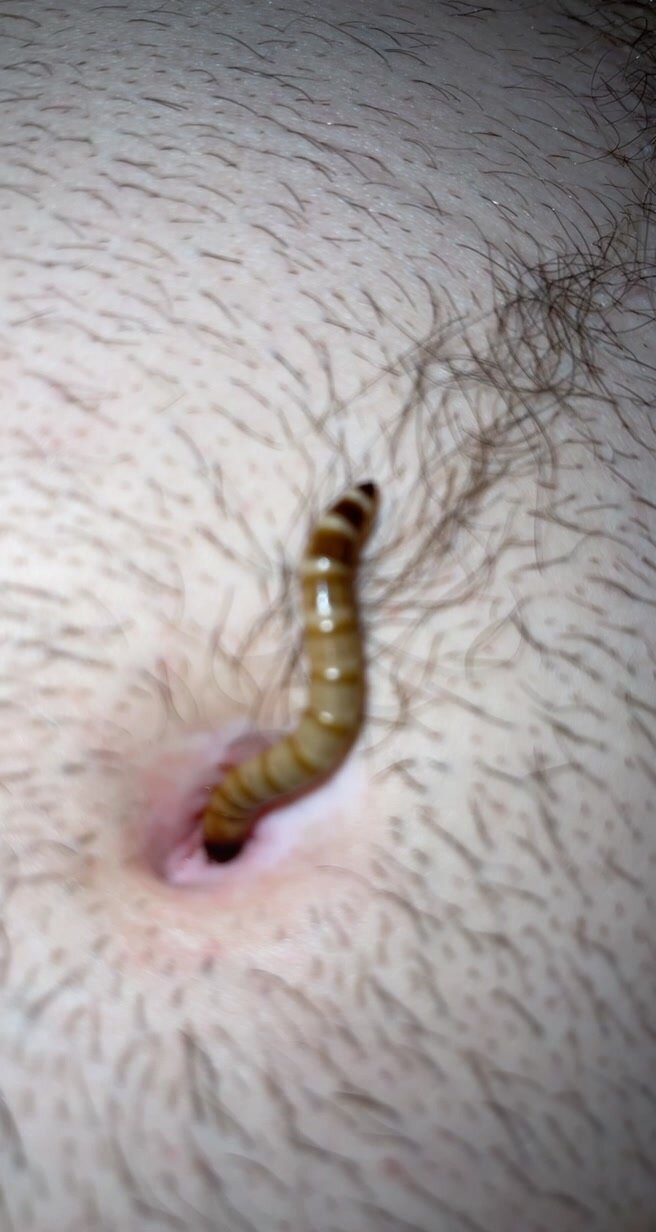 Part 2, close up of superworm