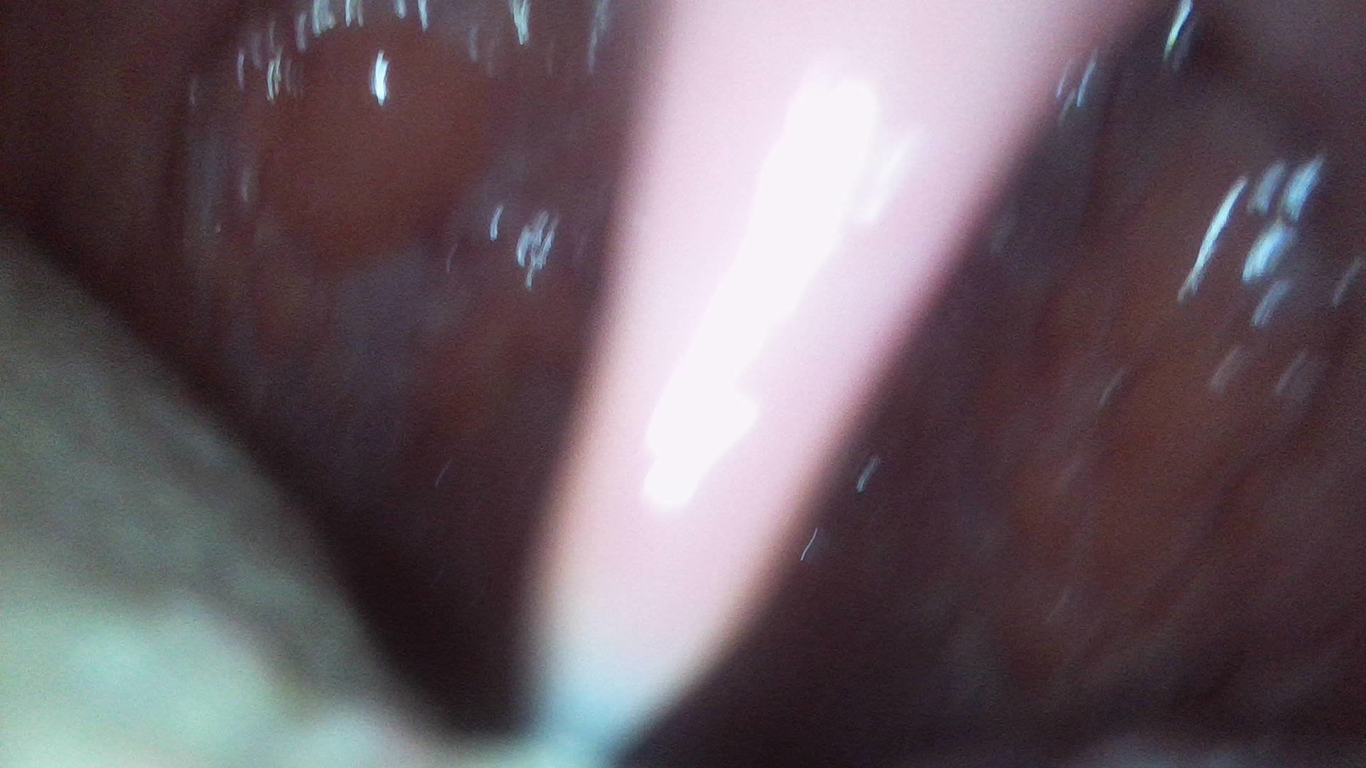 Mouth tour endoscope view