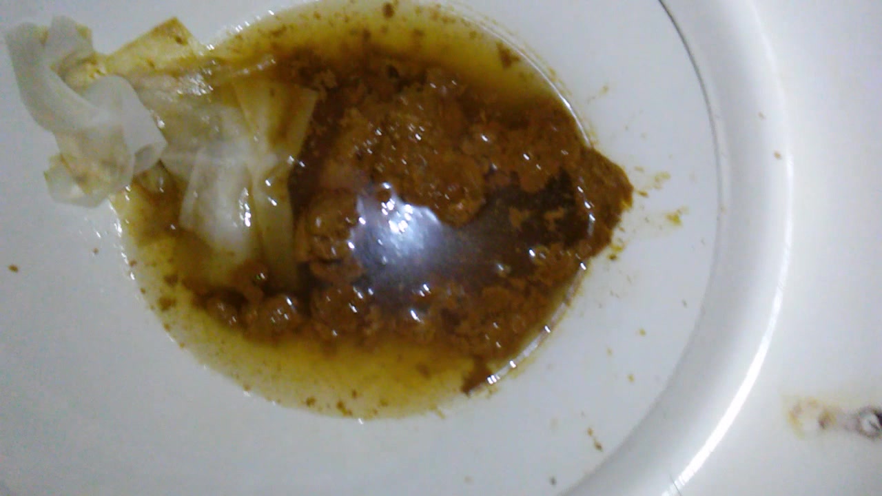 diarrhea after fast food breakfast pt 2