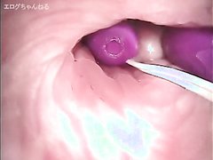 Japanese Camera inside Vagina