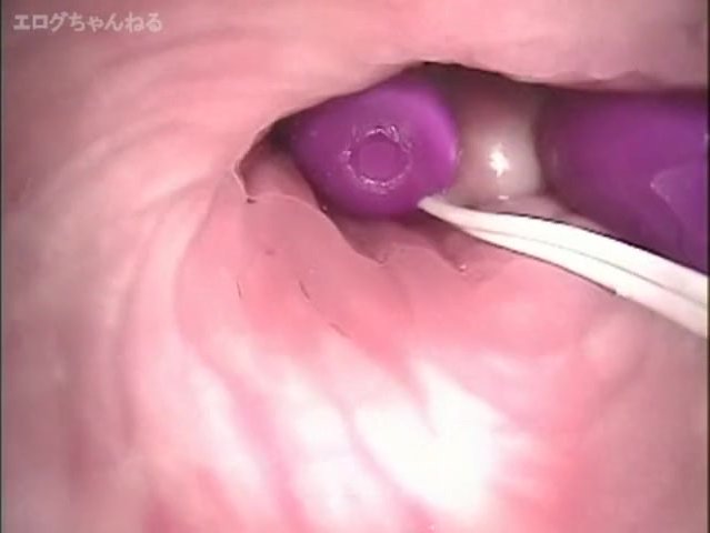 Endoscope: Japanese Camera inside Vagina - ThisVid.com