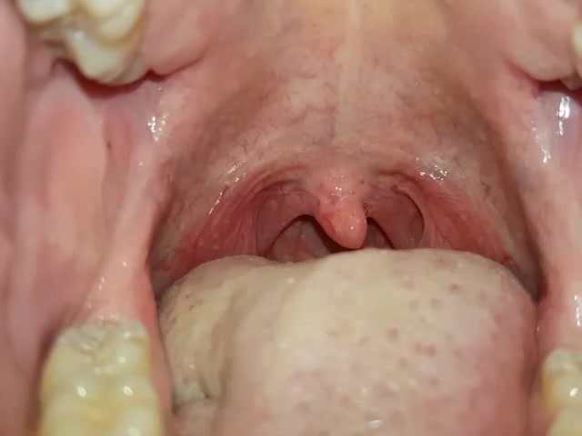 Mouthplay