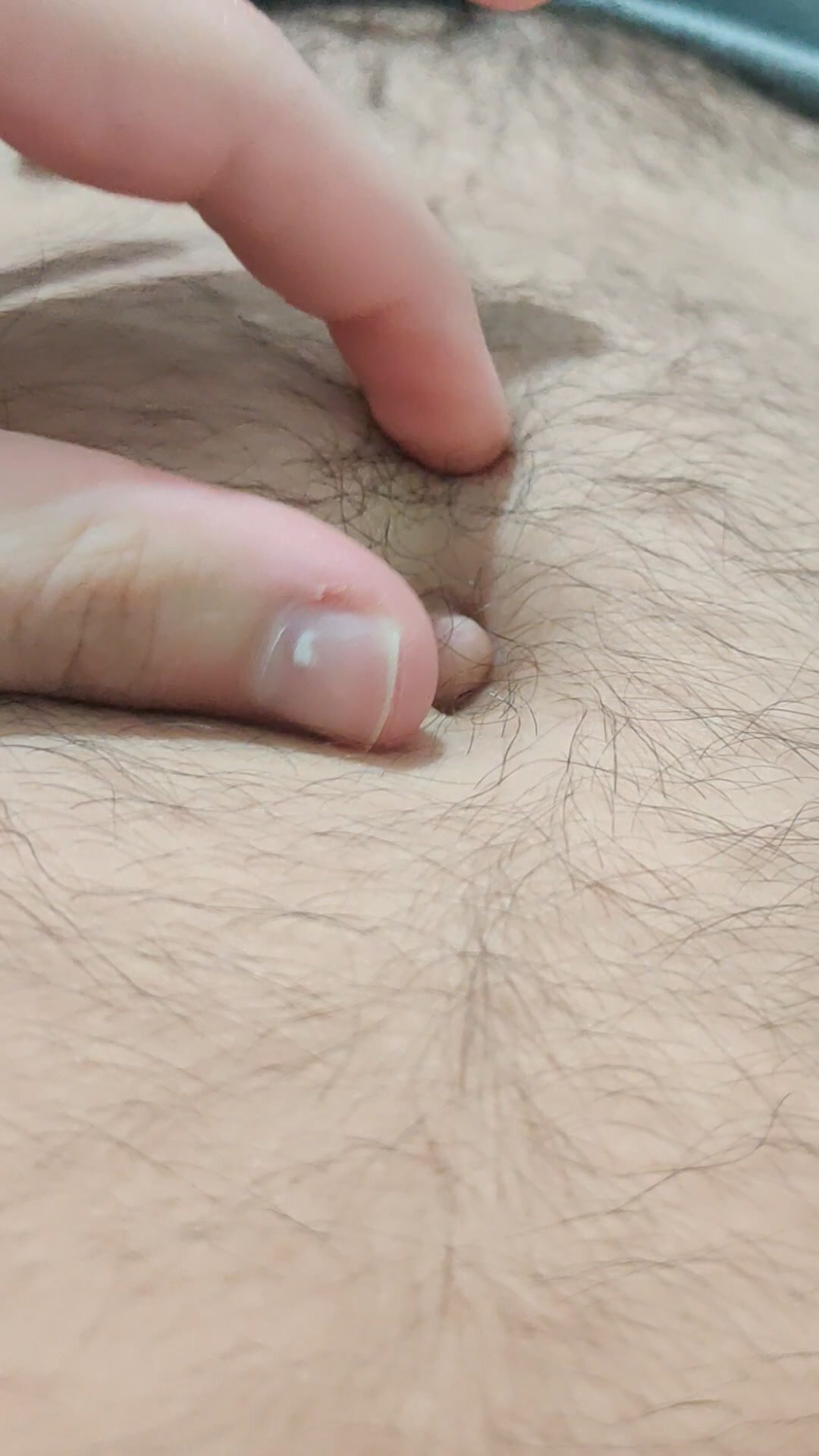 Outie belly button - video 2