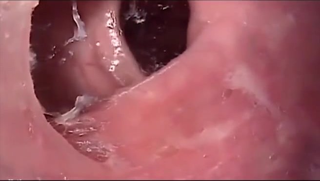 Up Pussy Girl Anal Endoscope Rectum Camera