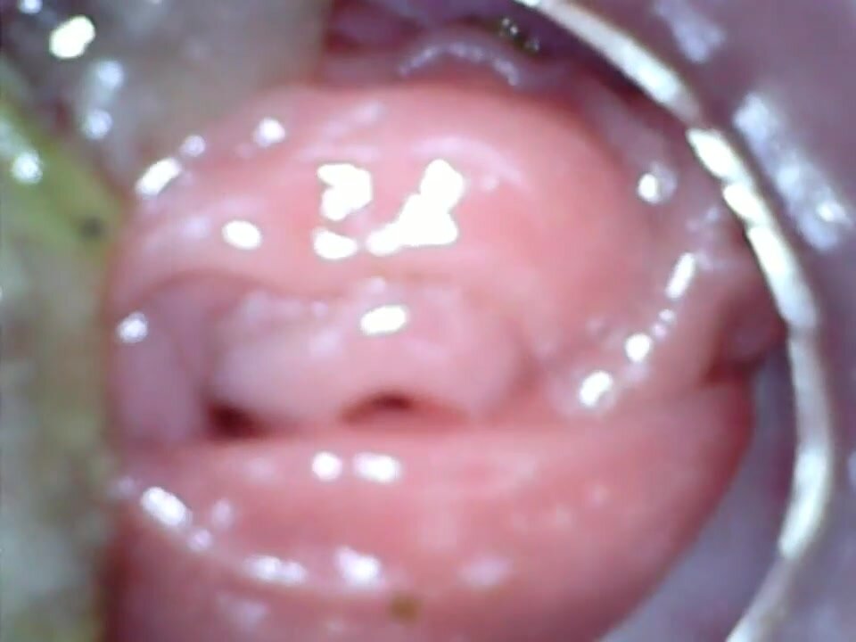 Girl Anal Endoscope Rectum Camera inside 2