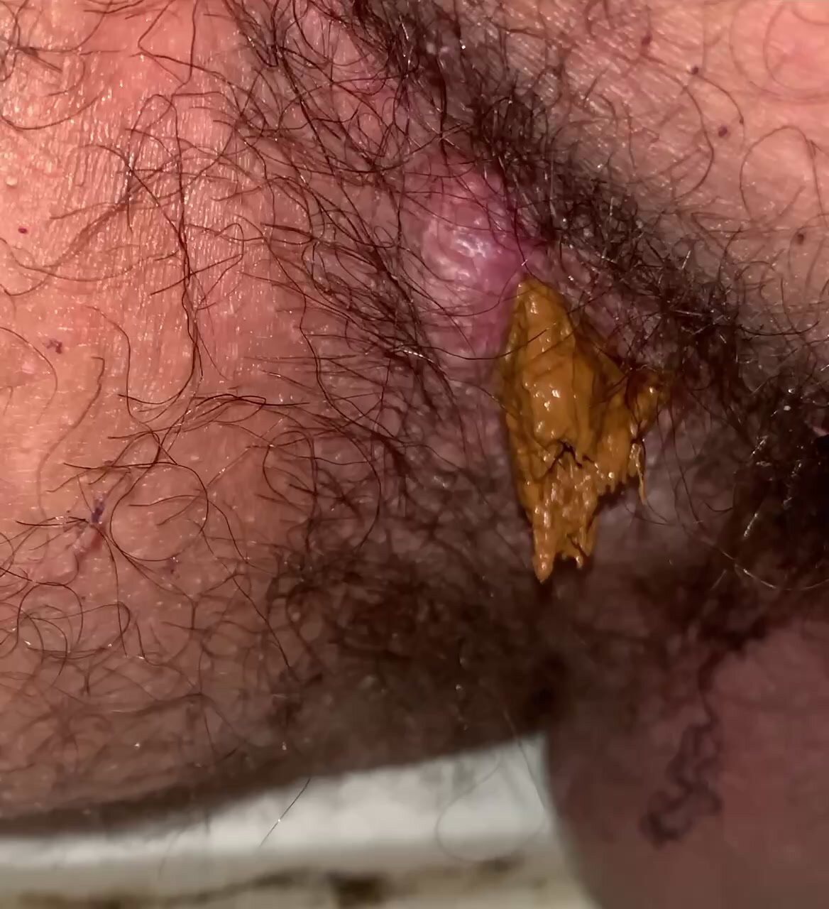 Teen scat after holding for a long time