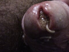 Maggots packed in cock hole