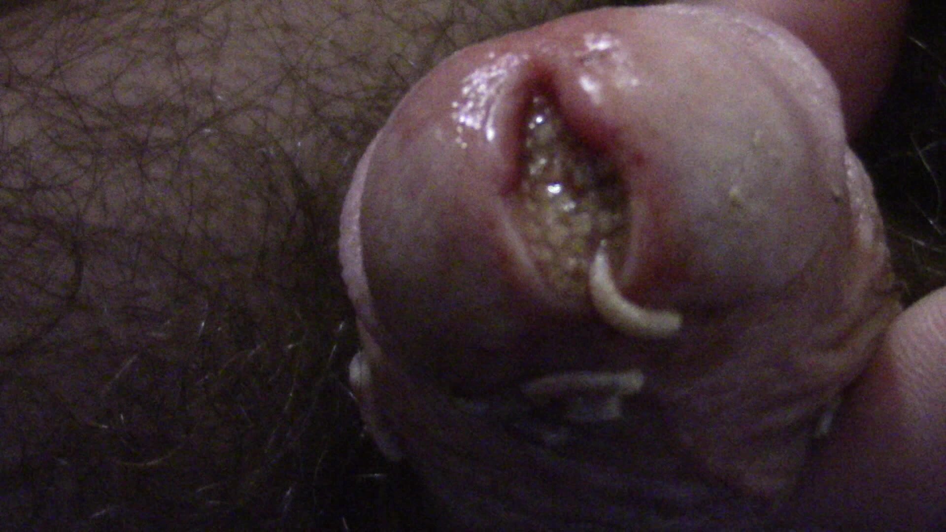 Maggots packed in cock hole
