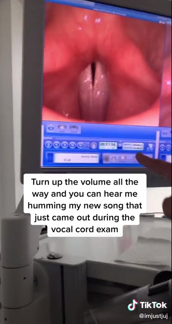 Tik tok vocal cords 1 part 2