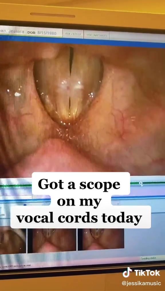 Tik tok vocal cords 2