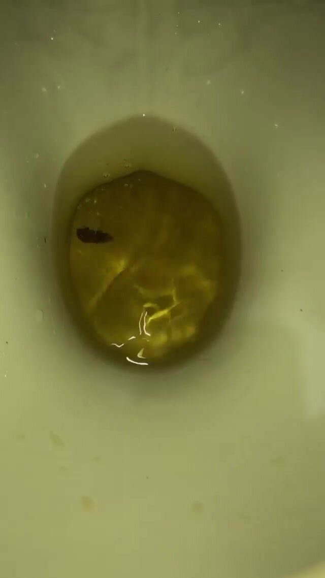 My girlfriend's poop 4