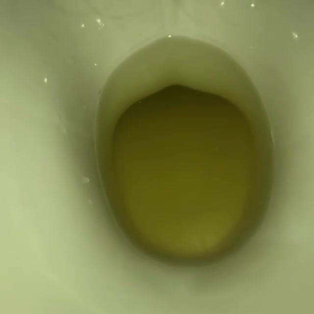 My girlfriend's poop 7