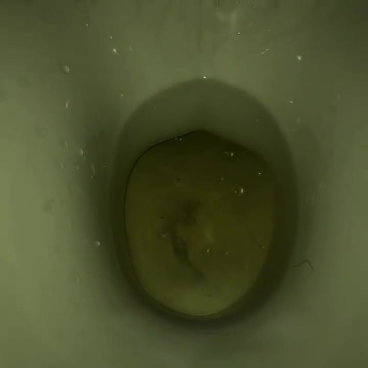 My girlfriend's poop 8