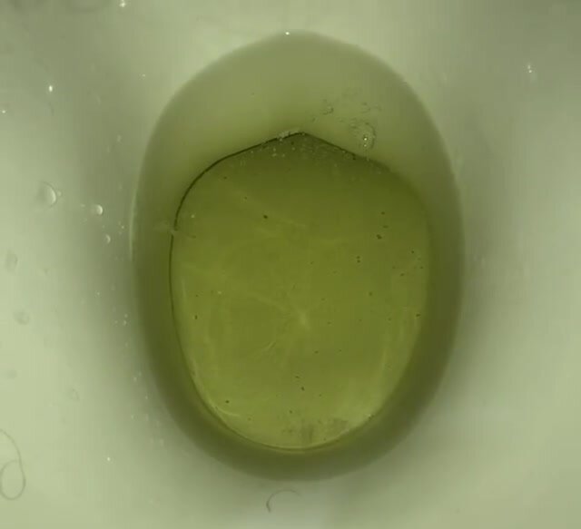 My girlfriend's poop 9