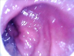 Endoscope camera inside my ass