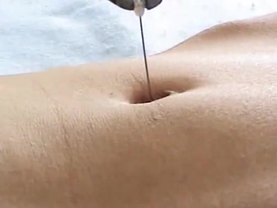 needle in belly button
