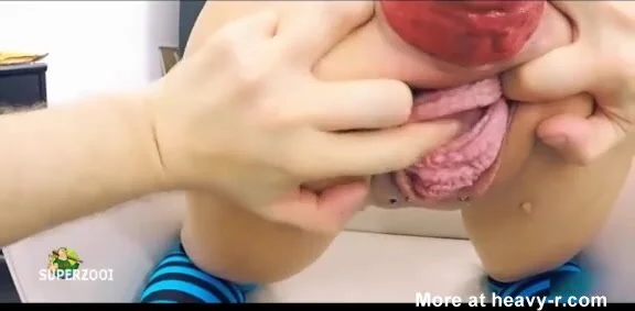 576px x 283px - Anal and vaginal fisting with prolapse - ThisVid.com
