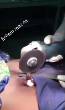 removing penis ring
