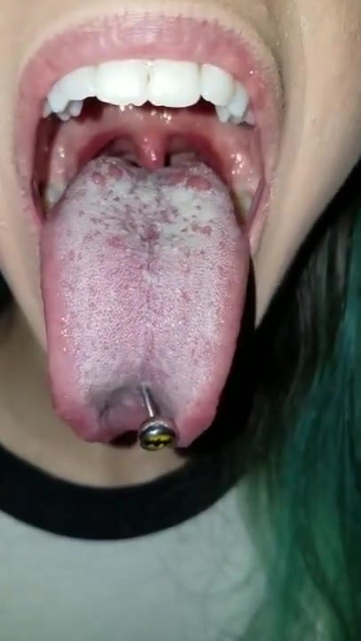 Mouth and uvula close up - ThisVid.com