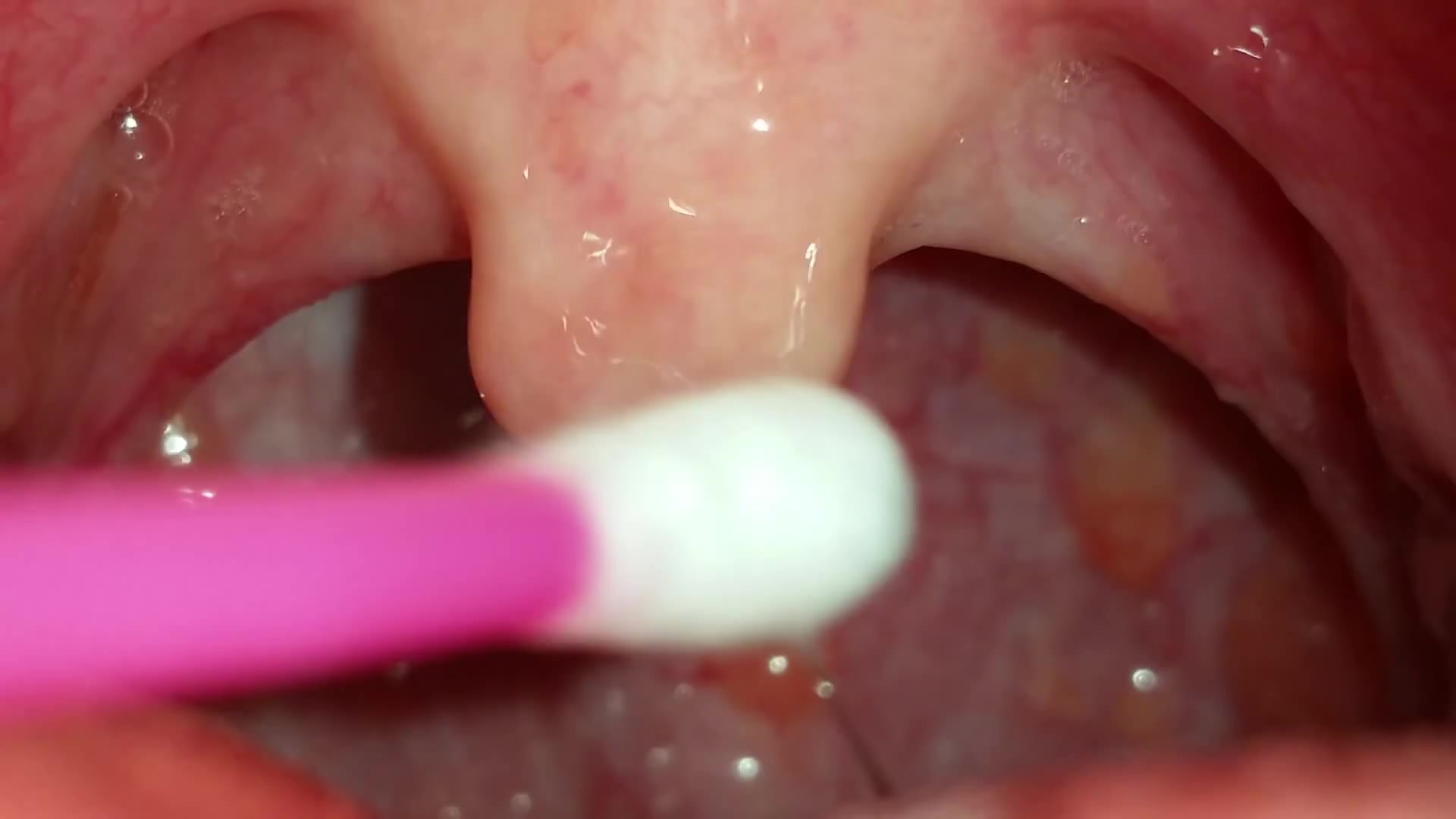 Mouth and uvula close-up - video 2