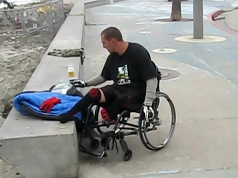 Amputee dancer looses wheelchair