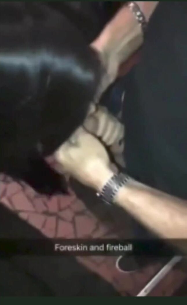 Foreskin shot