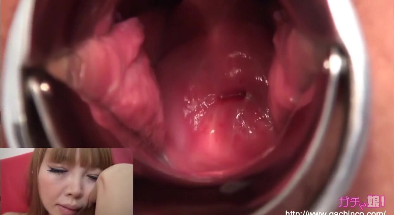 Clitoral orgasm causes strong contractions of cervix