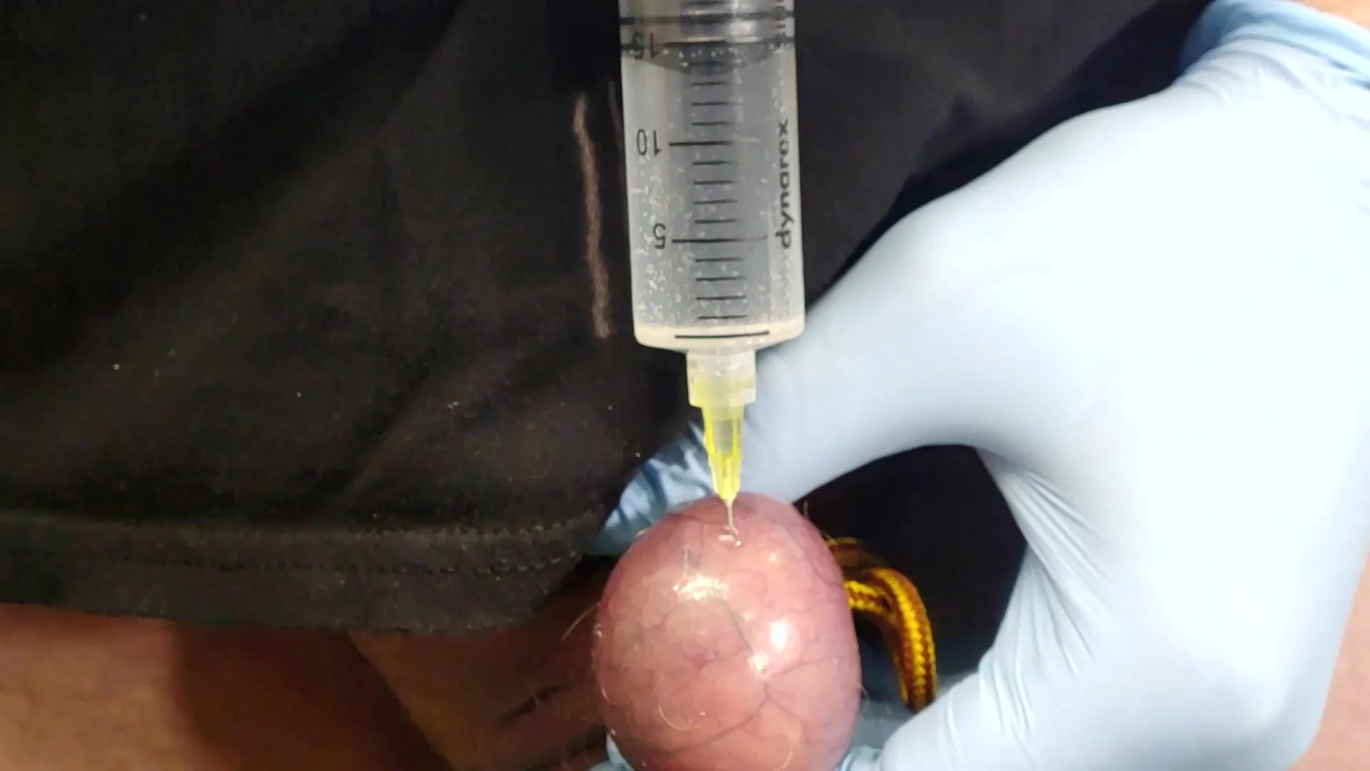 20cc Testicle Saline Injection - ThisVid.com