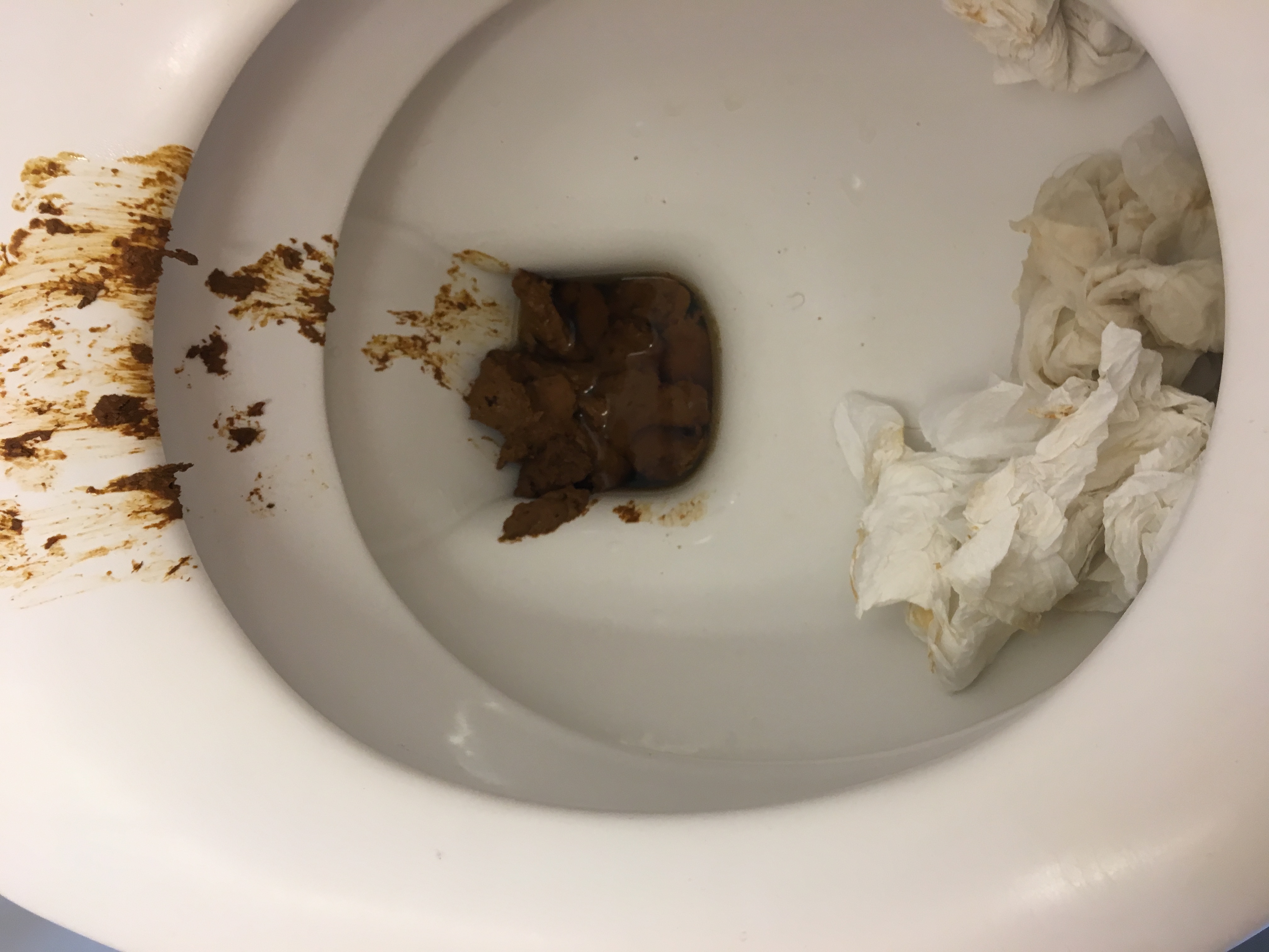 shitting on public toilet 04/10/2018 2