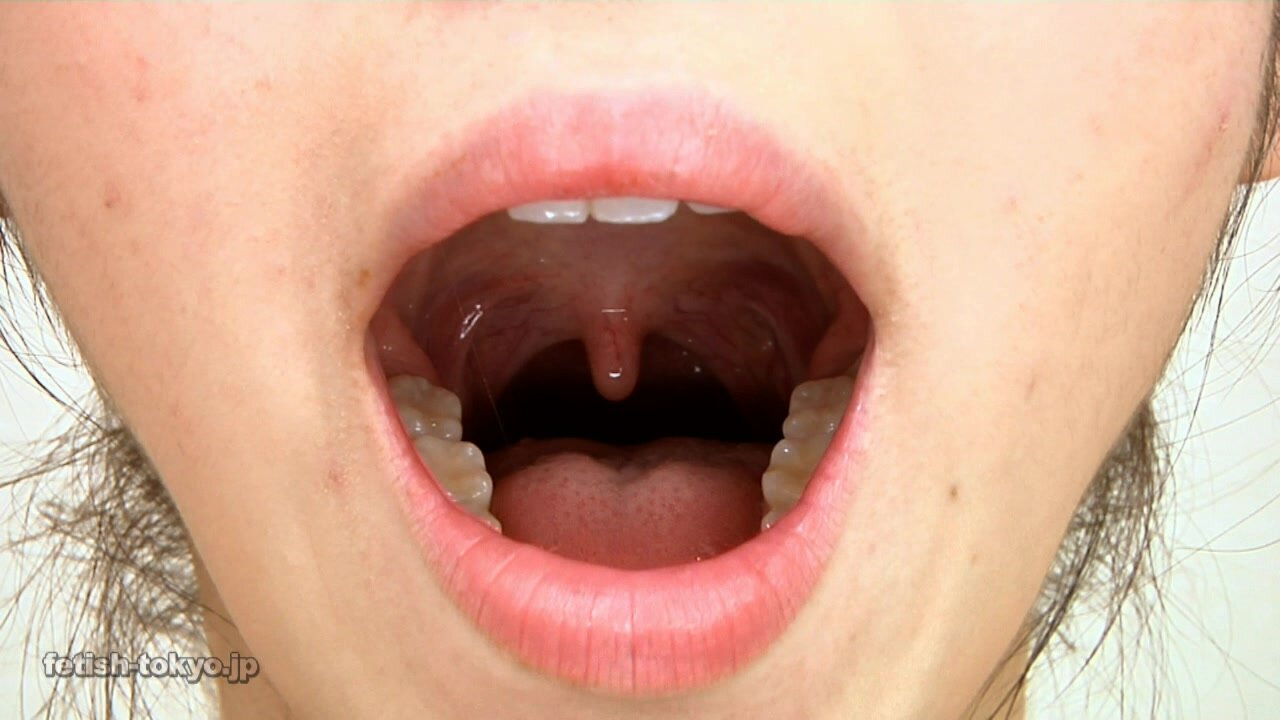 Asian Uvula (7)