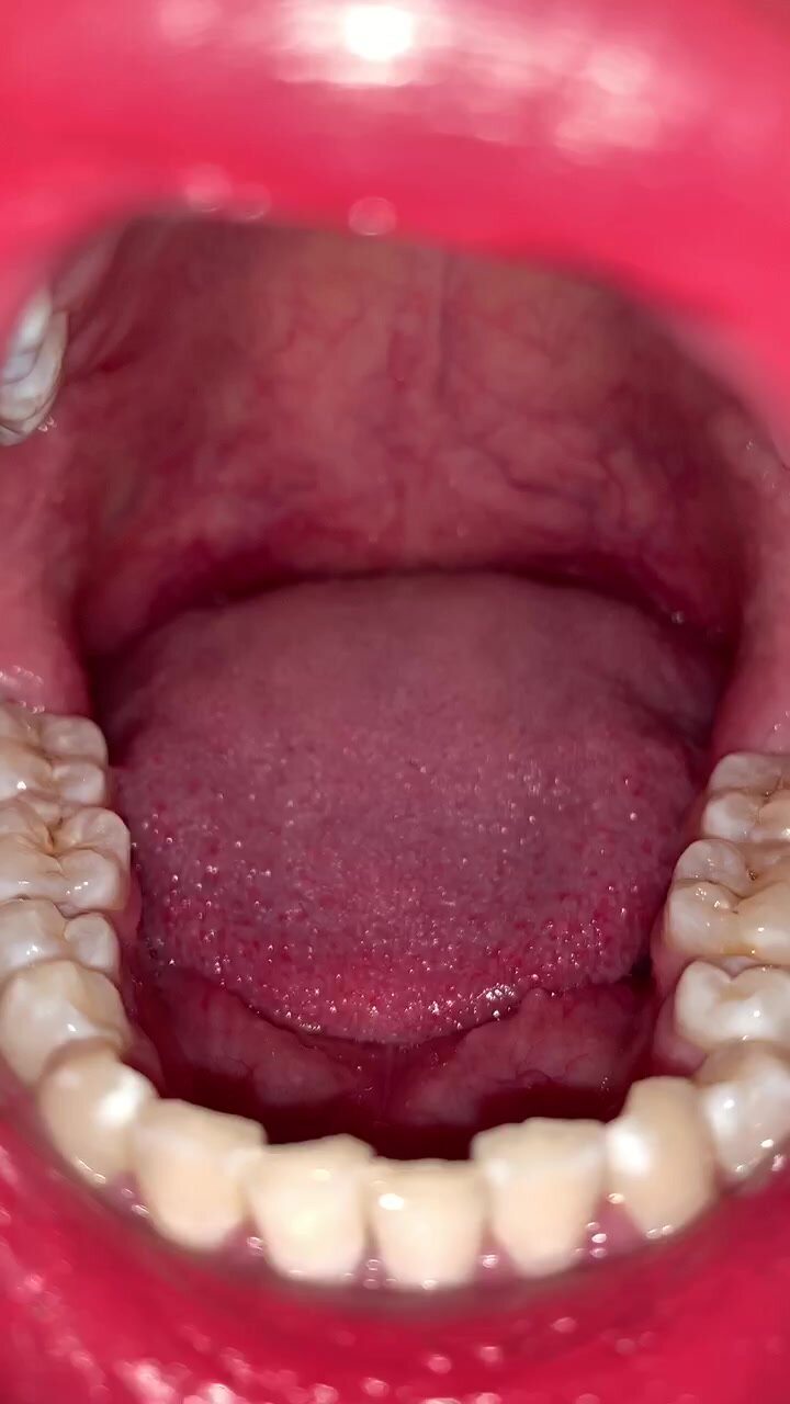 girl uvula 2