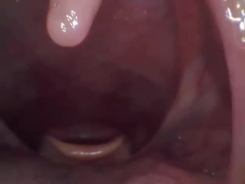 uvula/throat endoscope