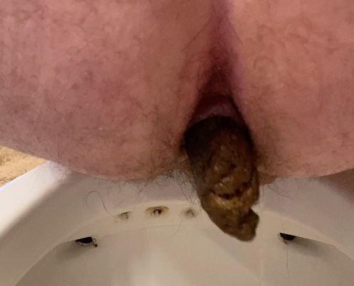 Shit Ripples Out of My Hole