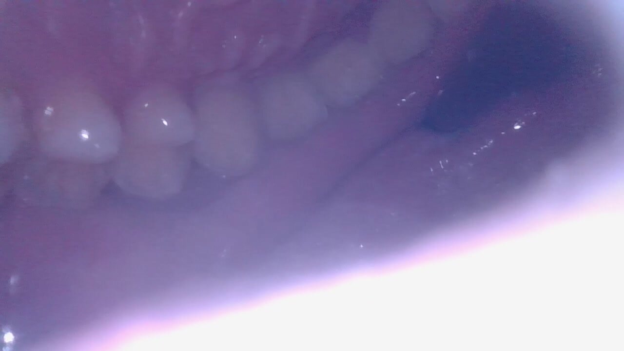 Inside my mouth - video 2