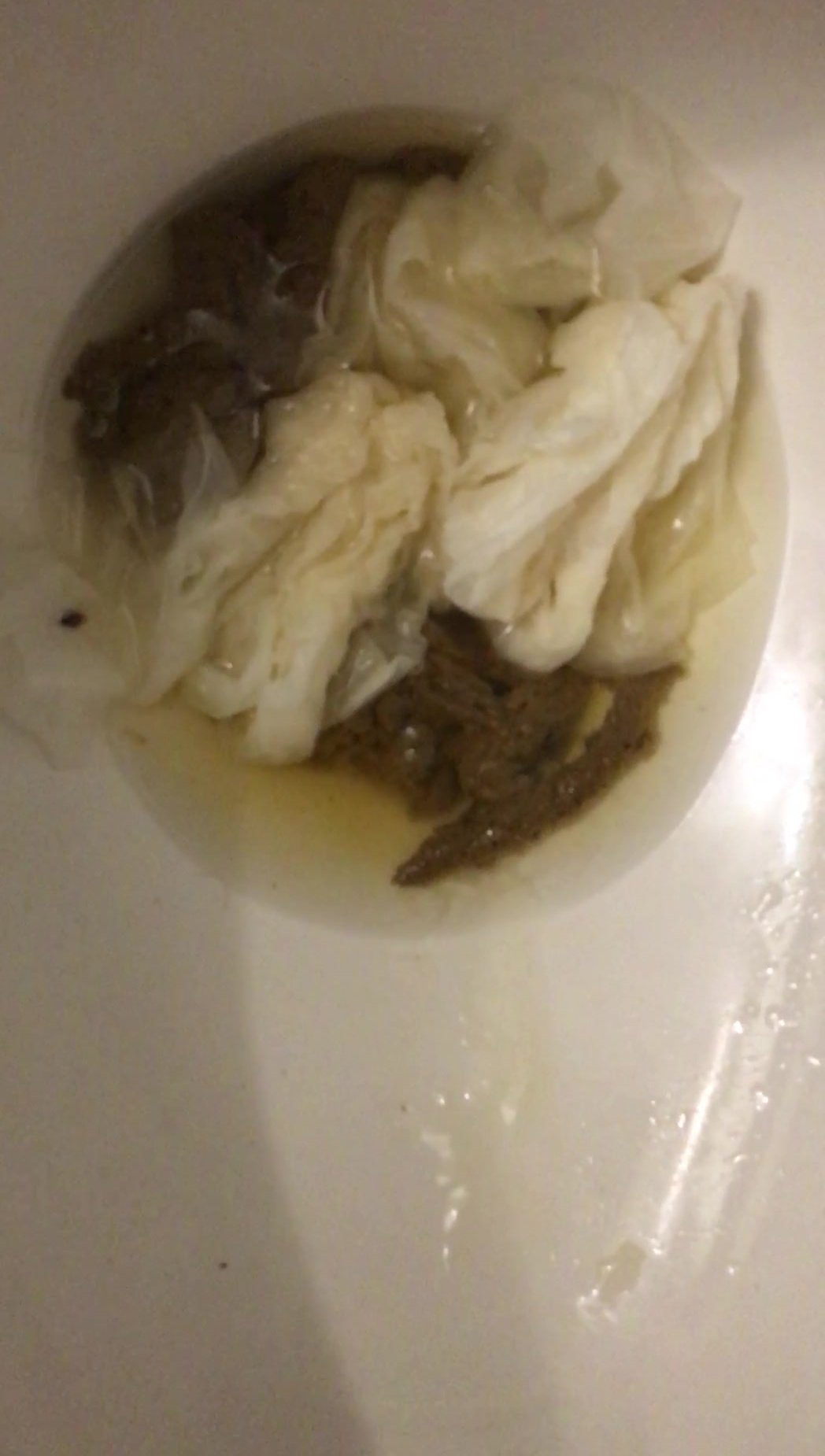 Flushing My Poop
