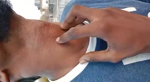 Adam’s apple - video 43