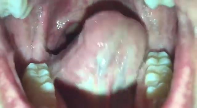 Mouth and throat - video 2