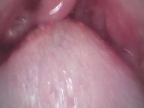 uvula endoscope