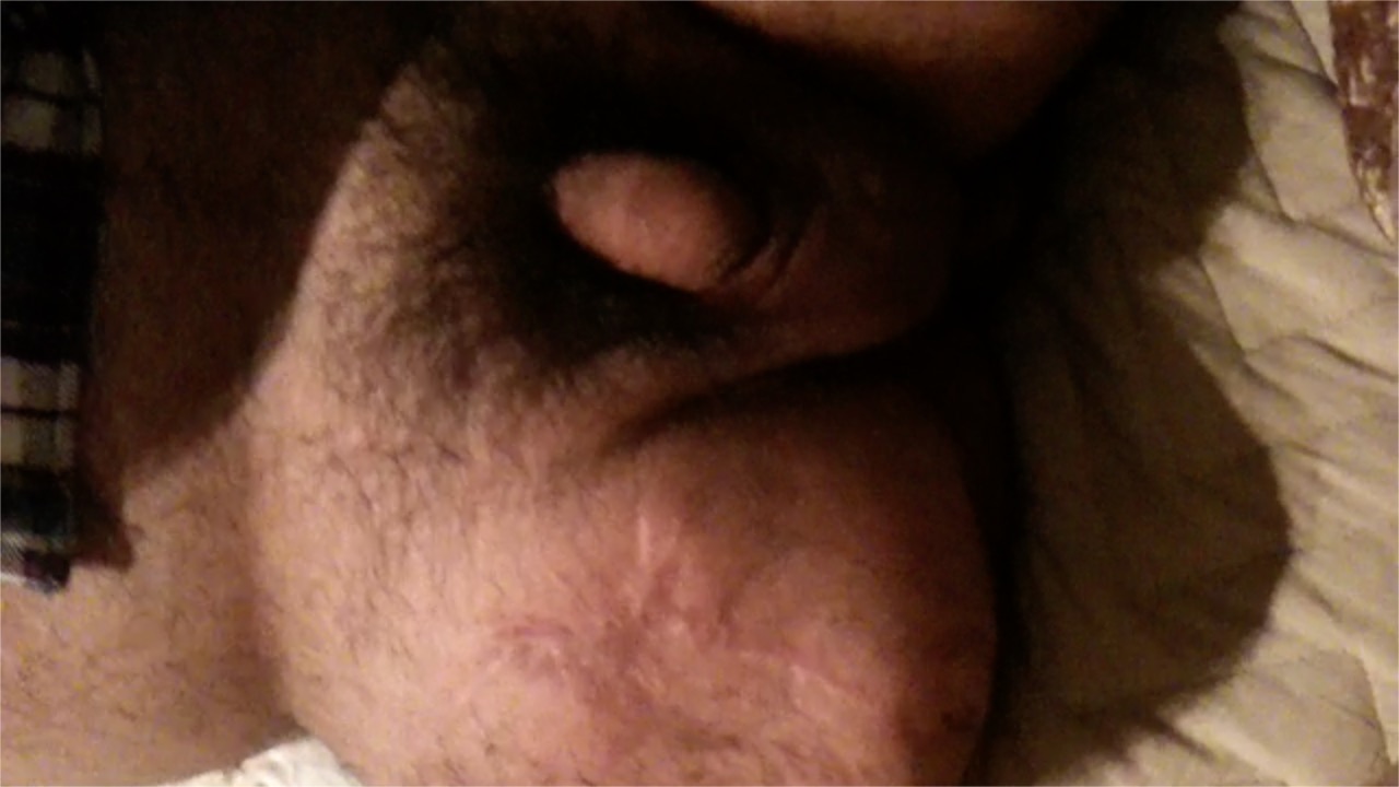 DAK chubby his cute phimosis