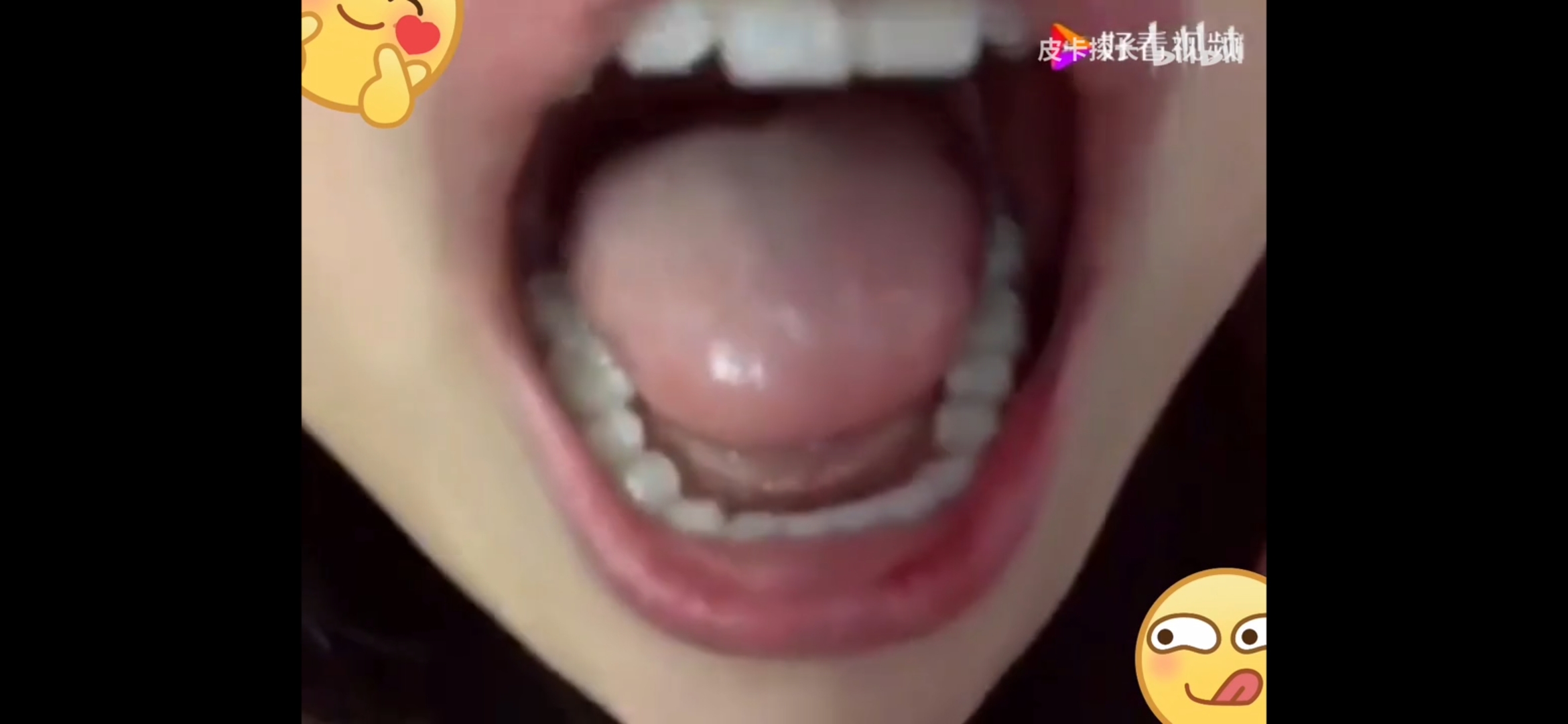 Chinese uvula2