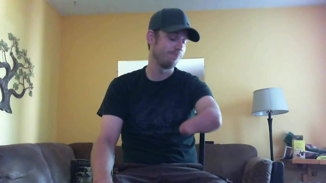 hand amputee - video 4