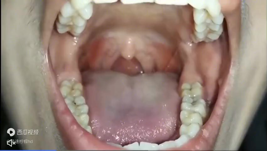 grils uvula02