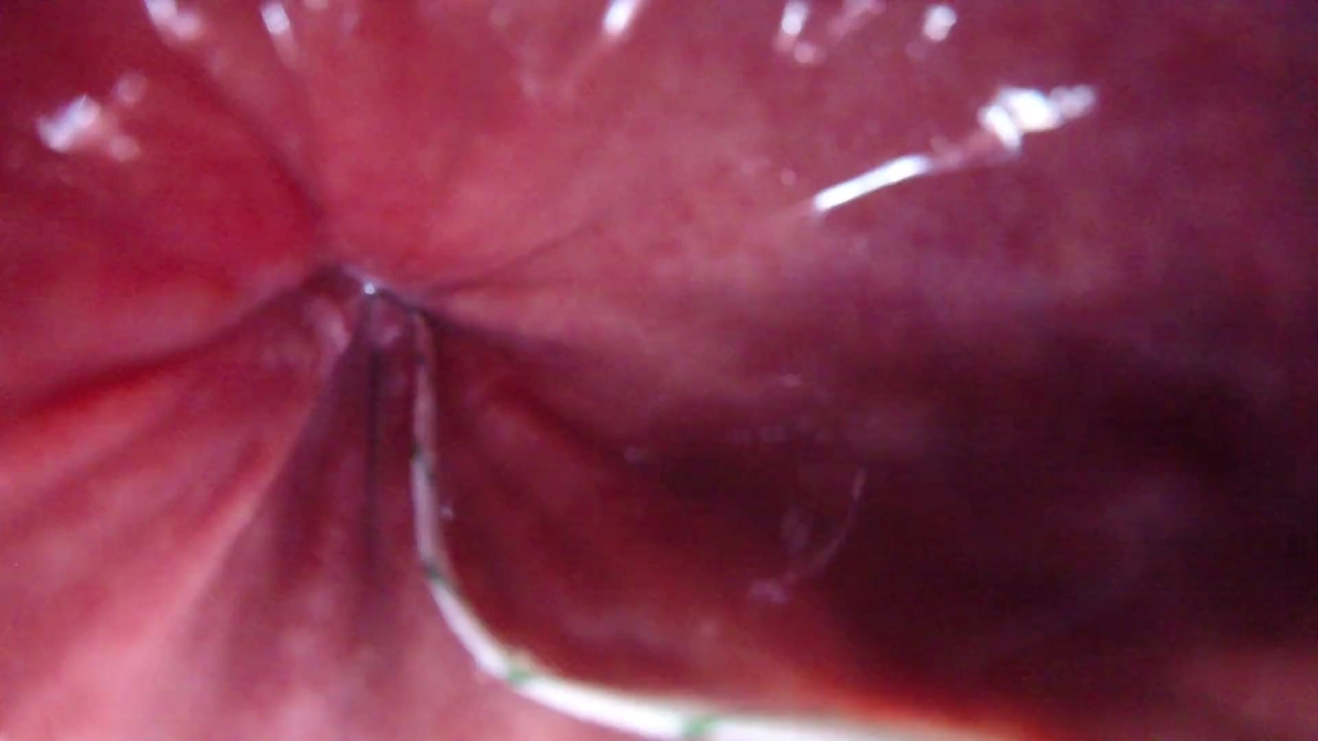 What It's Like To Be Inside Of A Man's Rectum