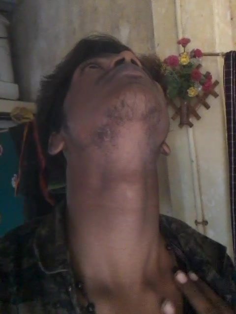 Adam’s apple - video 102