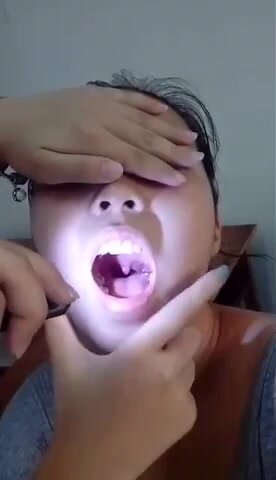 Asian Girl's uvula 07